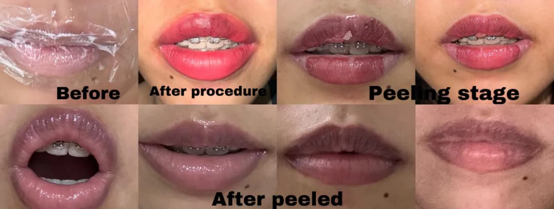 Gojenie ust po makijażu permanentnym: 7-14 dni do efektu