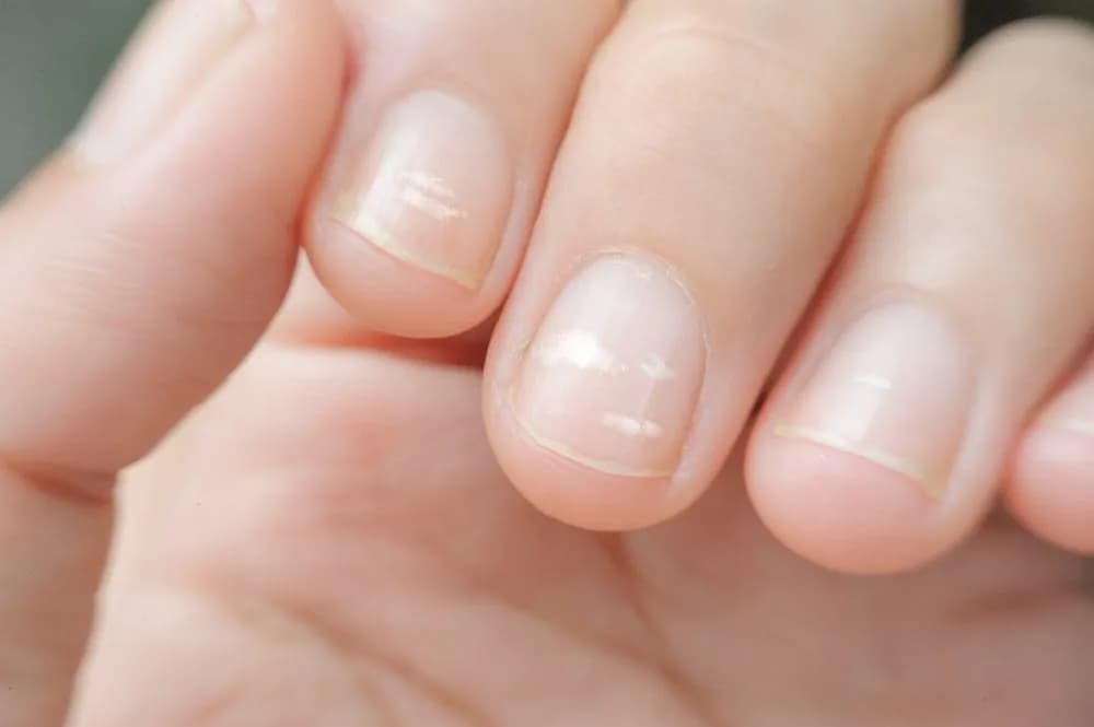 Najlepszy manicure na zniszczone paznokcie - 5 skutecznych metod